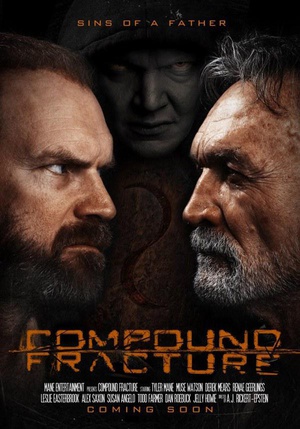 Ϲ Compound Fracture