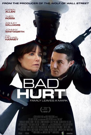ʹὫǲɢ Bad Hurt