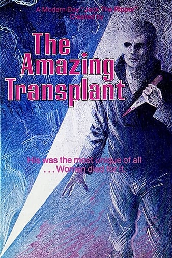 惊人的移植 The Amazing Transplant