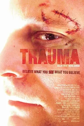  Trauma